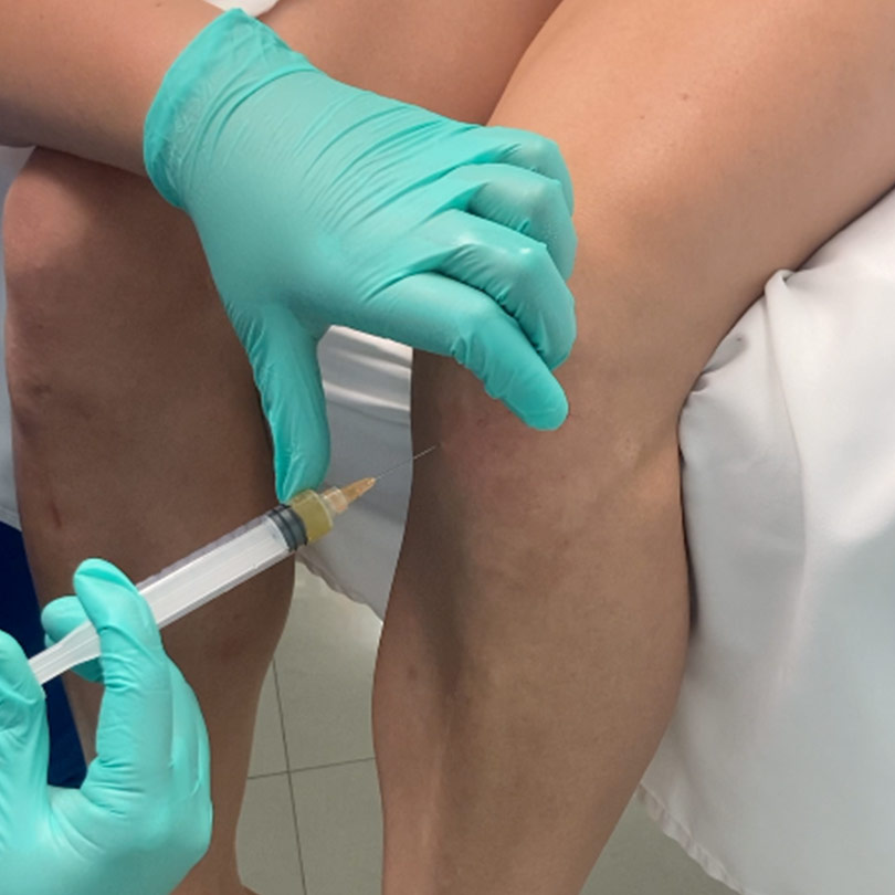 prp injections fort lauderdale