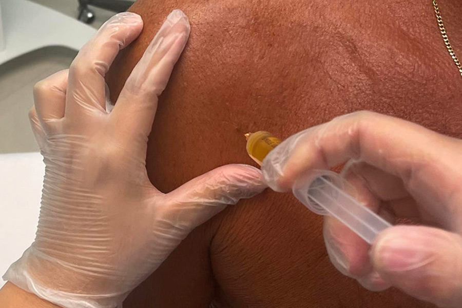 PRP Joint Injections Fort Lauderdale - Dr. Roxy Barber PRP & Aesthetics