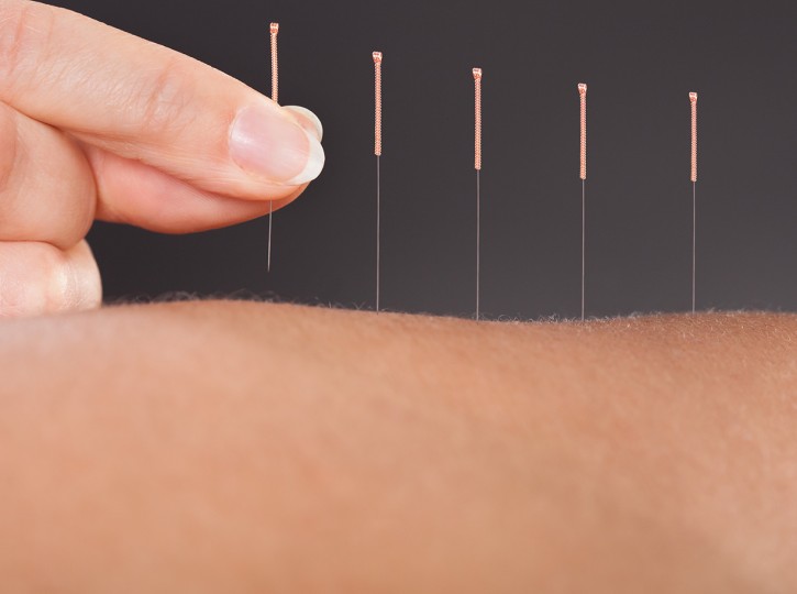 prp treatment fort lauderdale